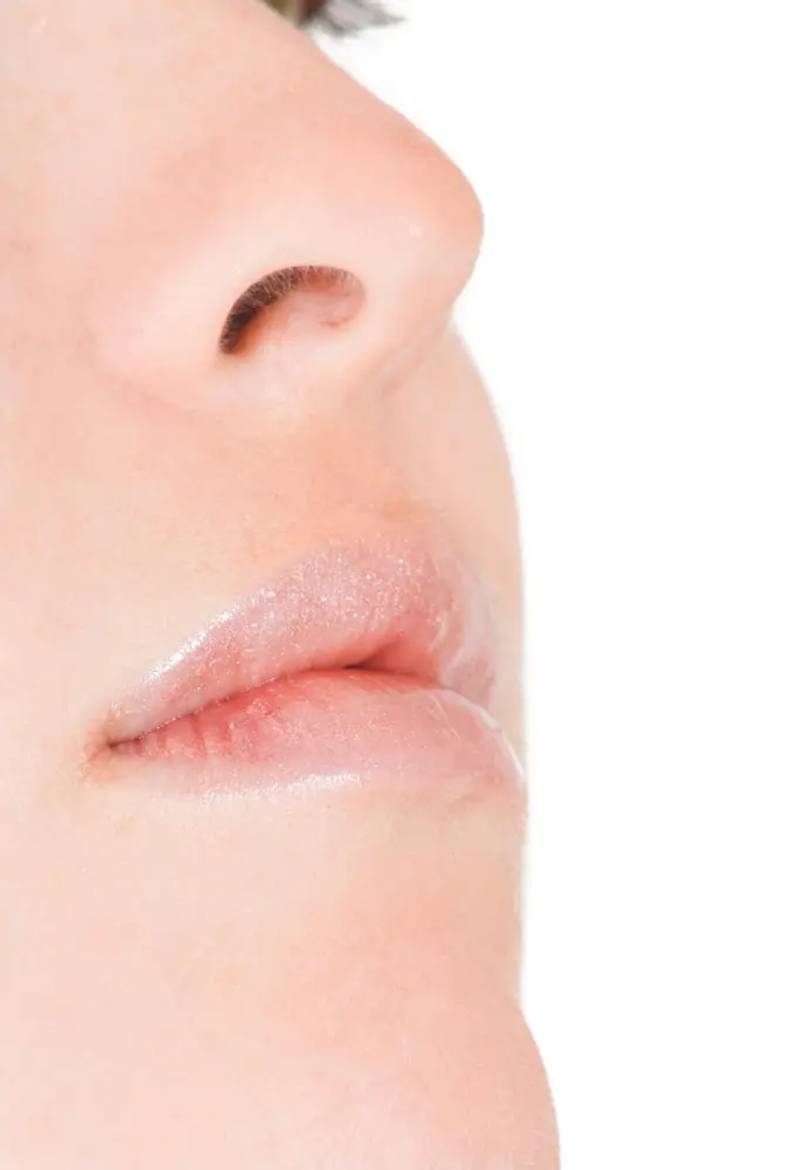 Video Blog: Mucosal Dermatology: Oral & Genital Cases