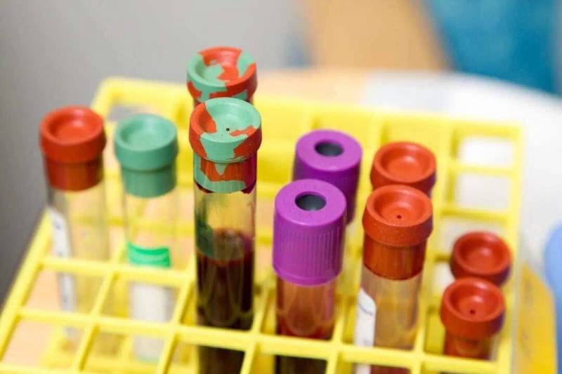 Isotretinoin Lab Monitoring: How Much is Too Much?
