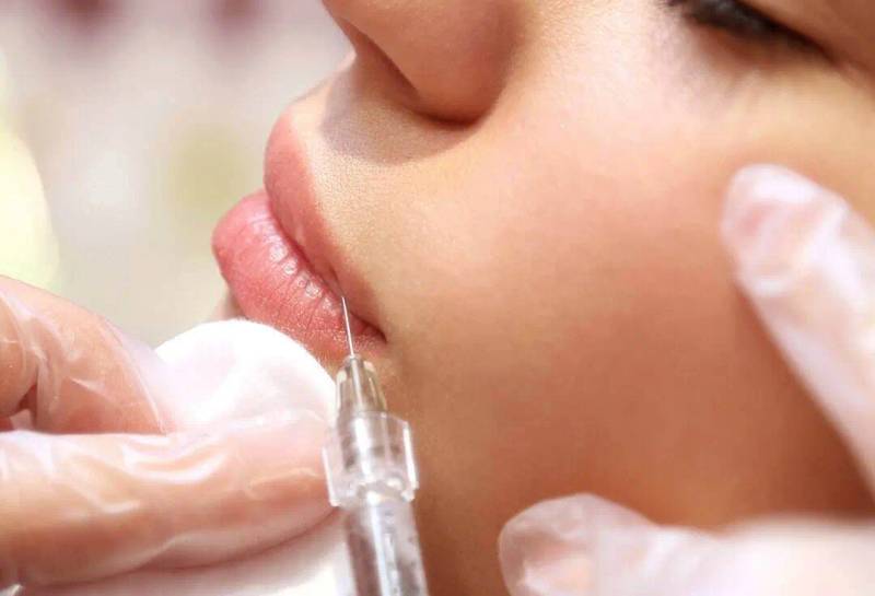 Hyaluronic Filler Comparisons