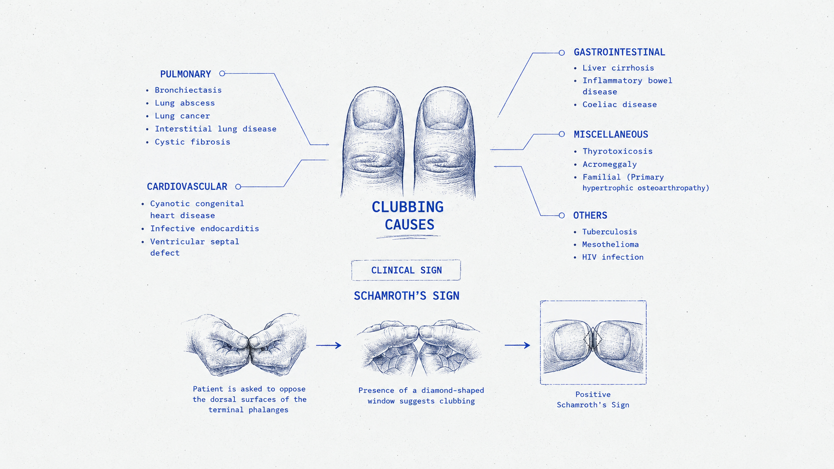 Clubbing Causes for NEET PG