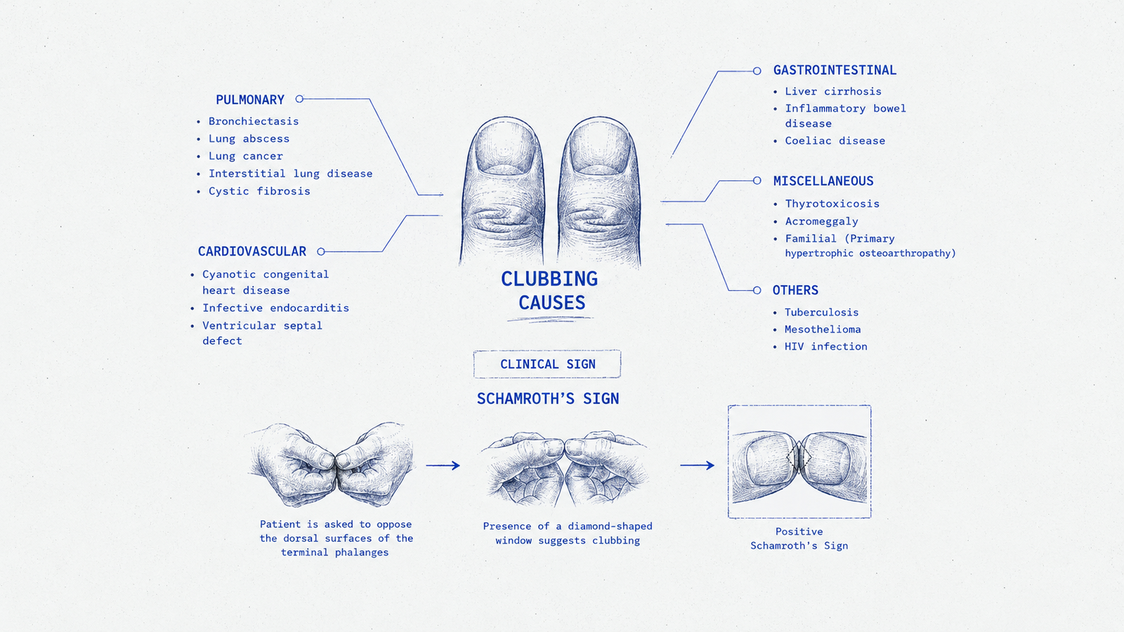 Clubbing Causes for NEET PG