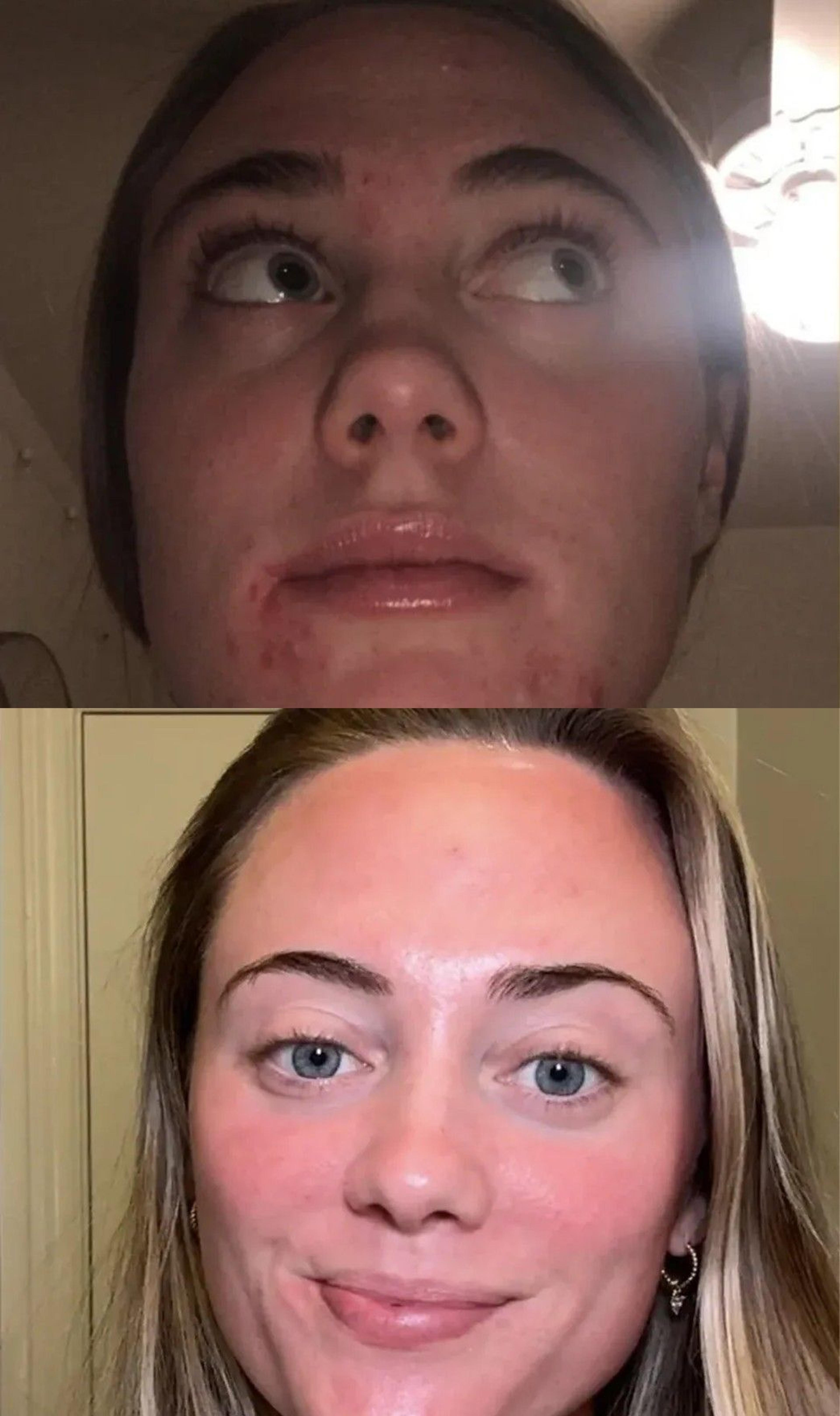 Nolla Derm patient before and after
