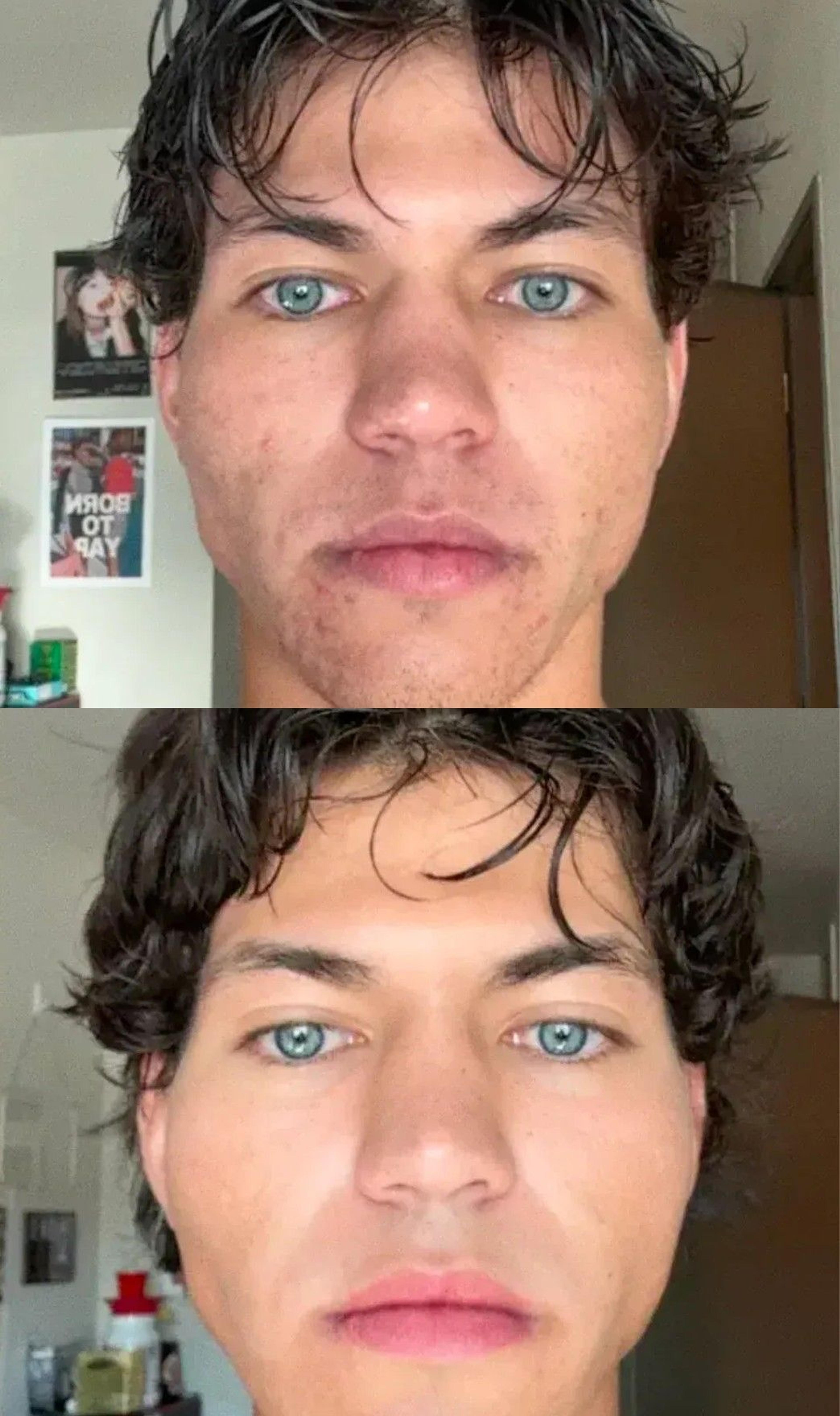 Nolla Derm patient before and after