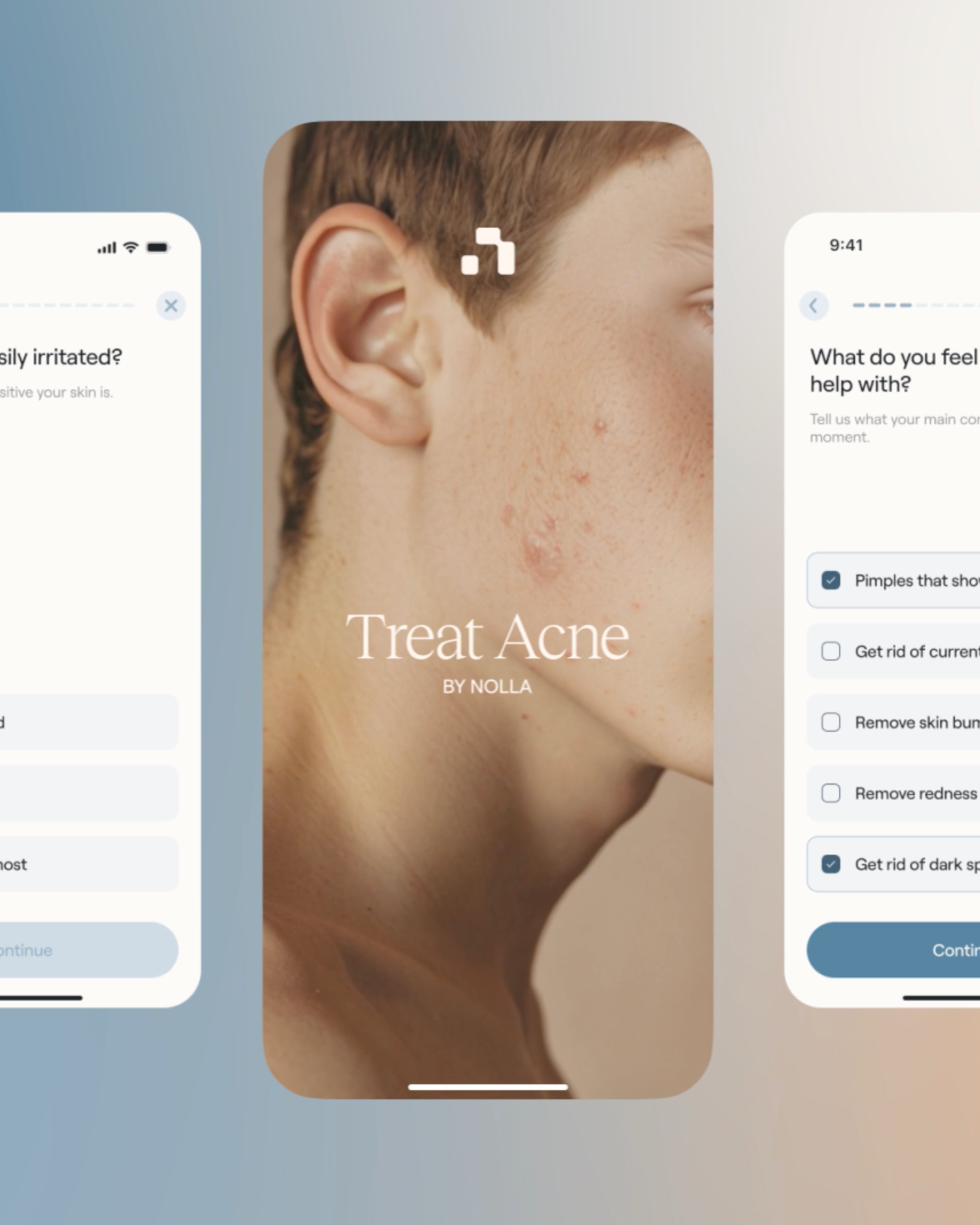 The Nolla Acne App