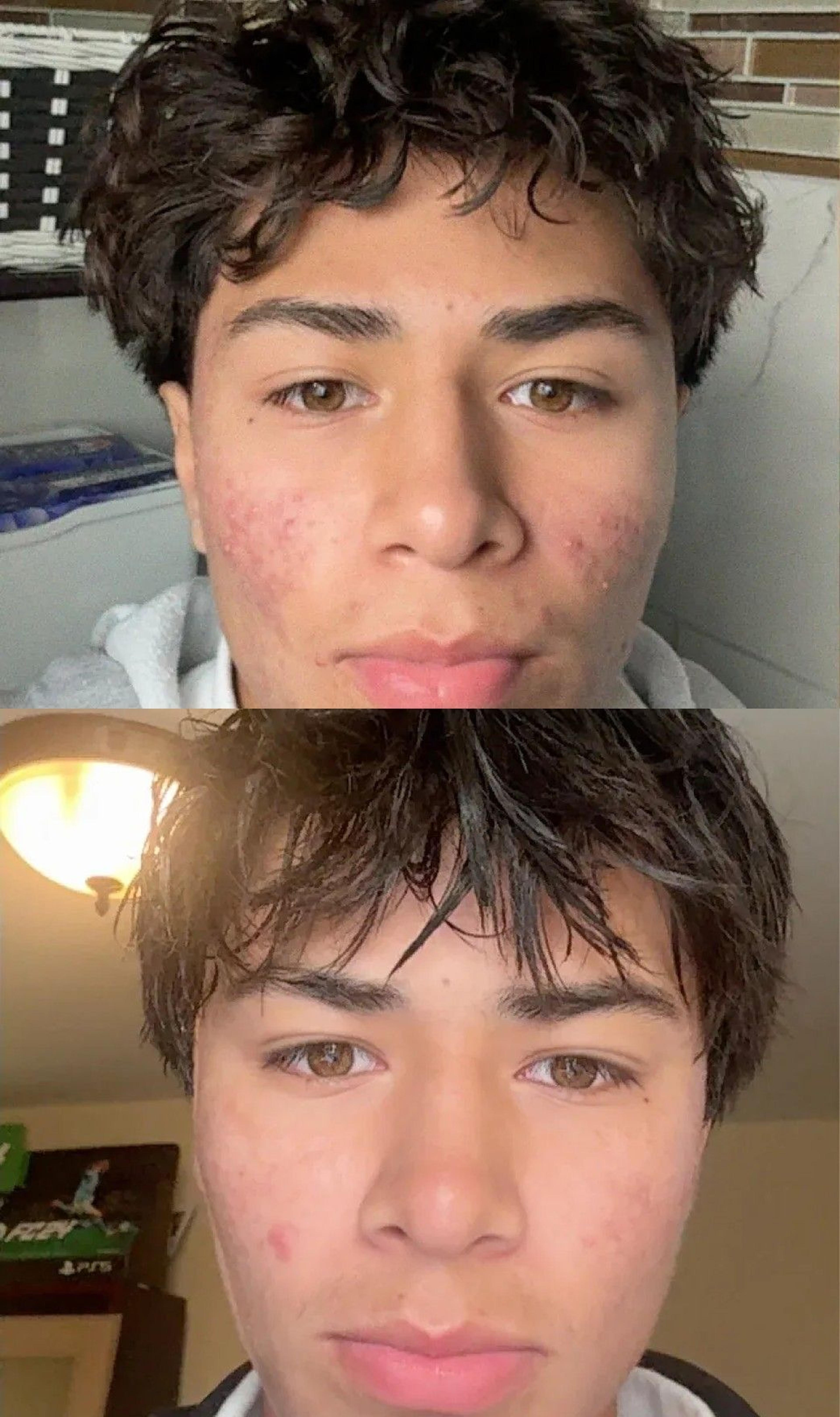 Nolla Derm patient before and after