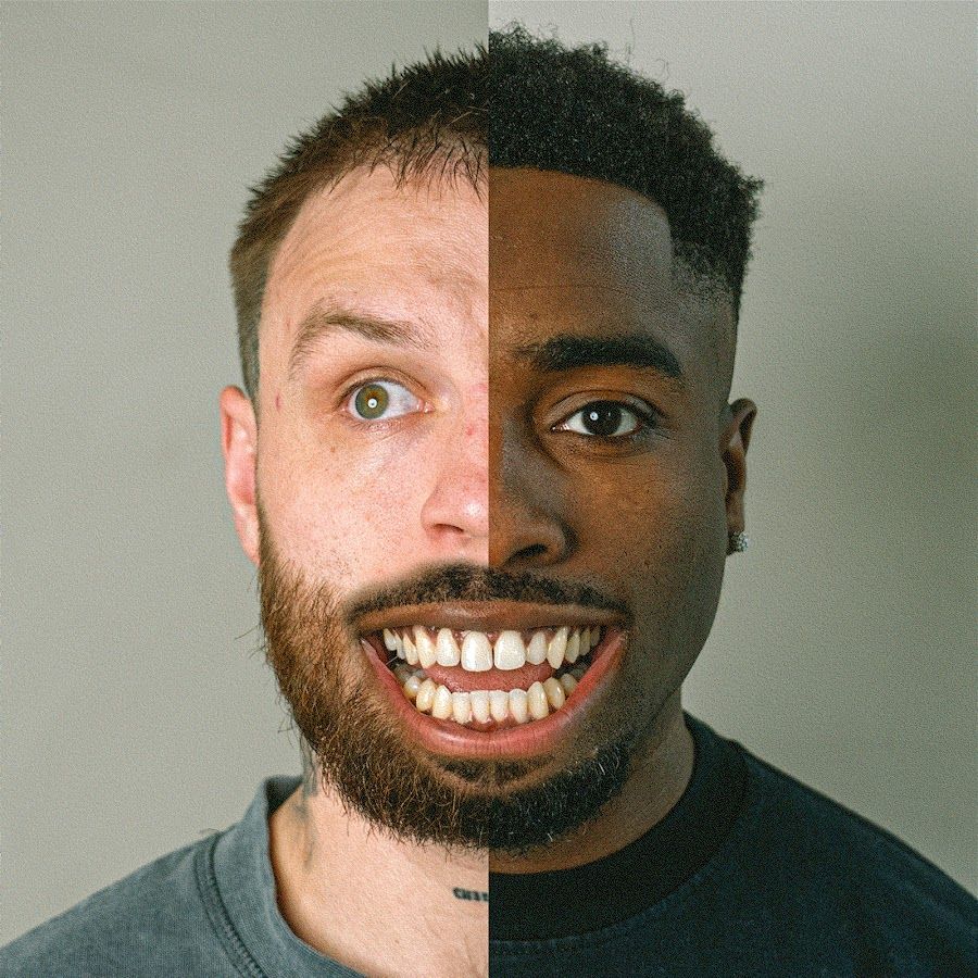 TGFbro