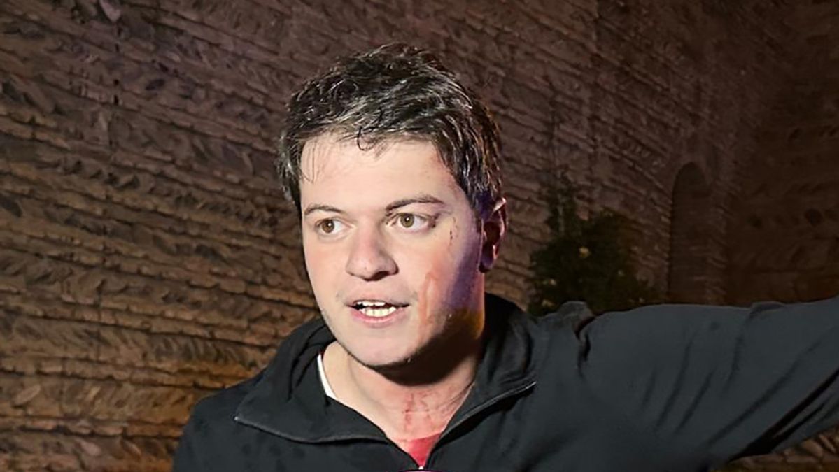 Brutální napadení gruzínského politika!