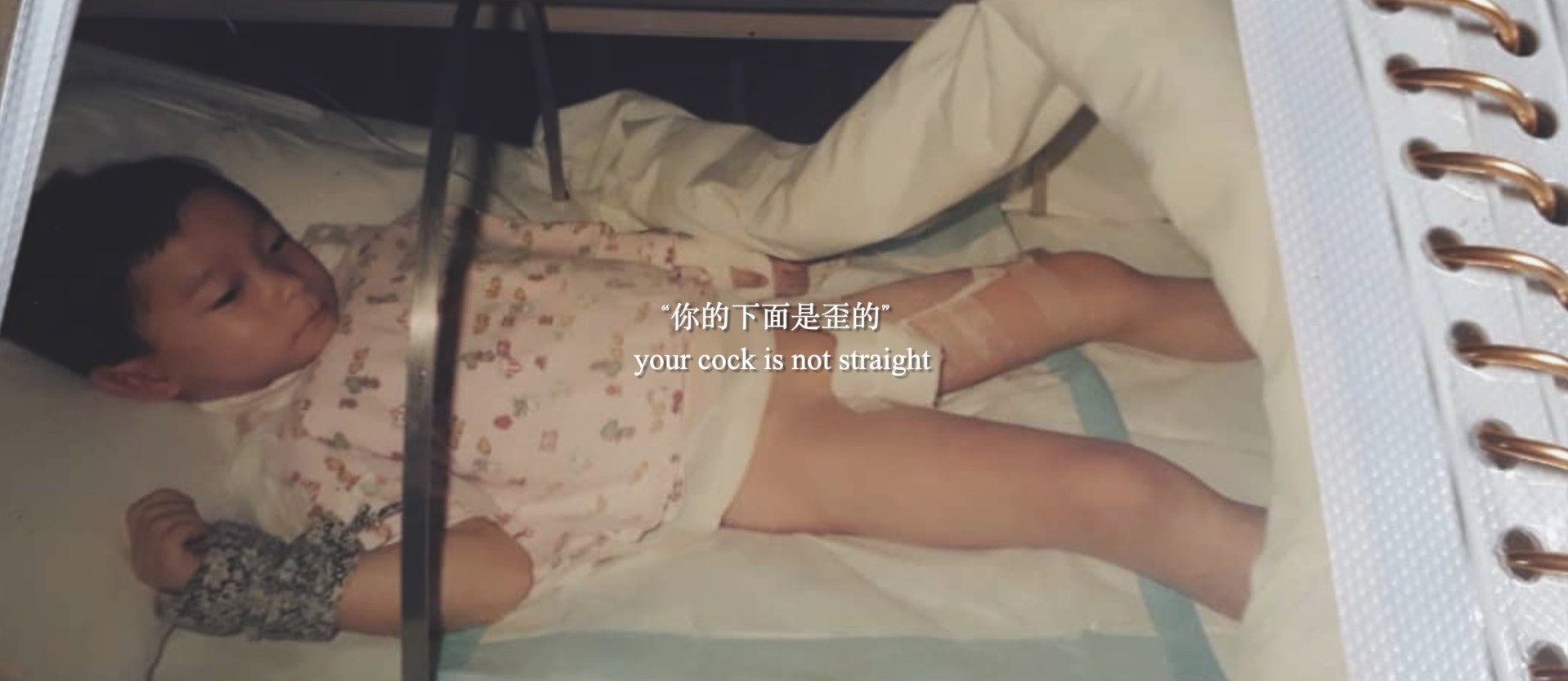 a young child in a hospital bed