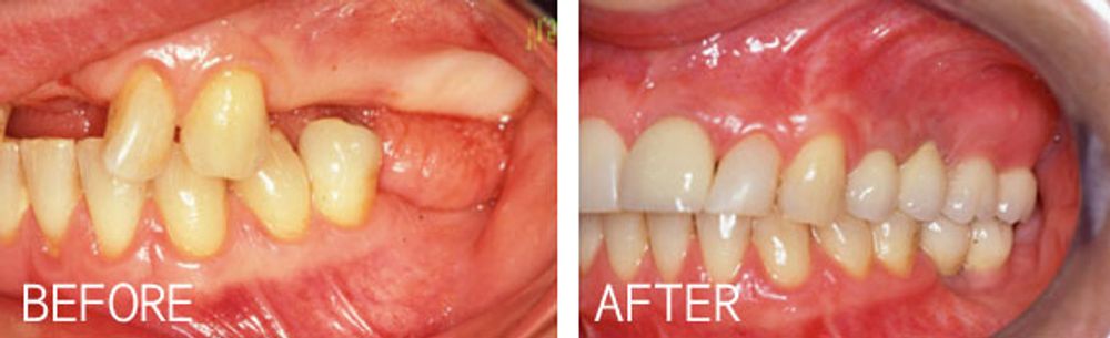Case 2