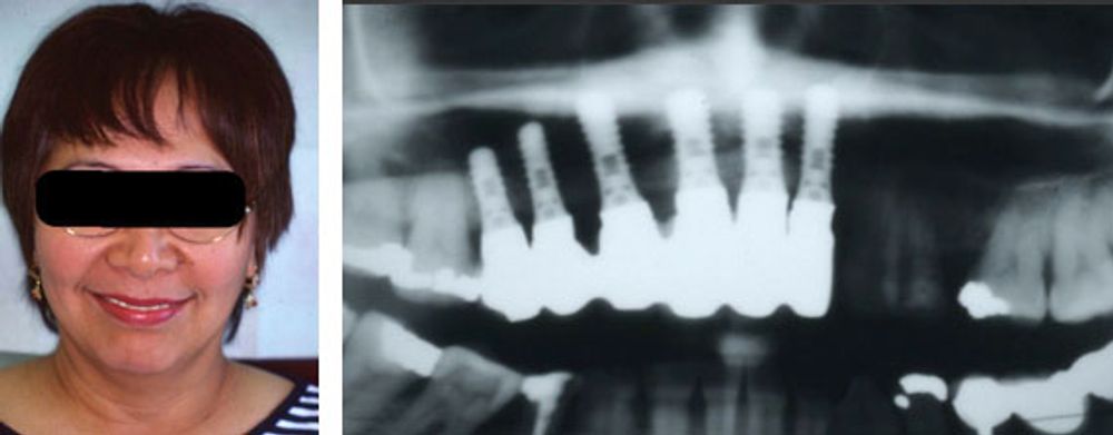 Case 4