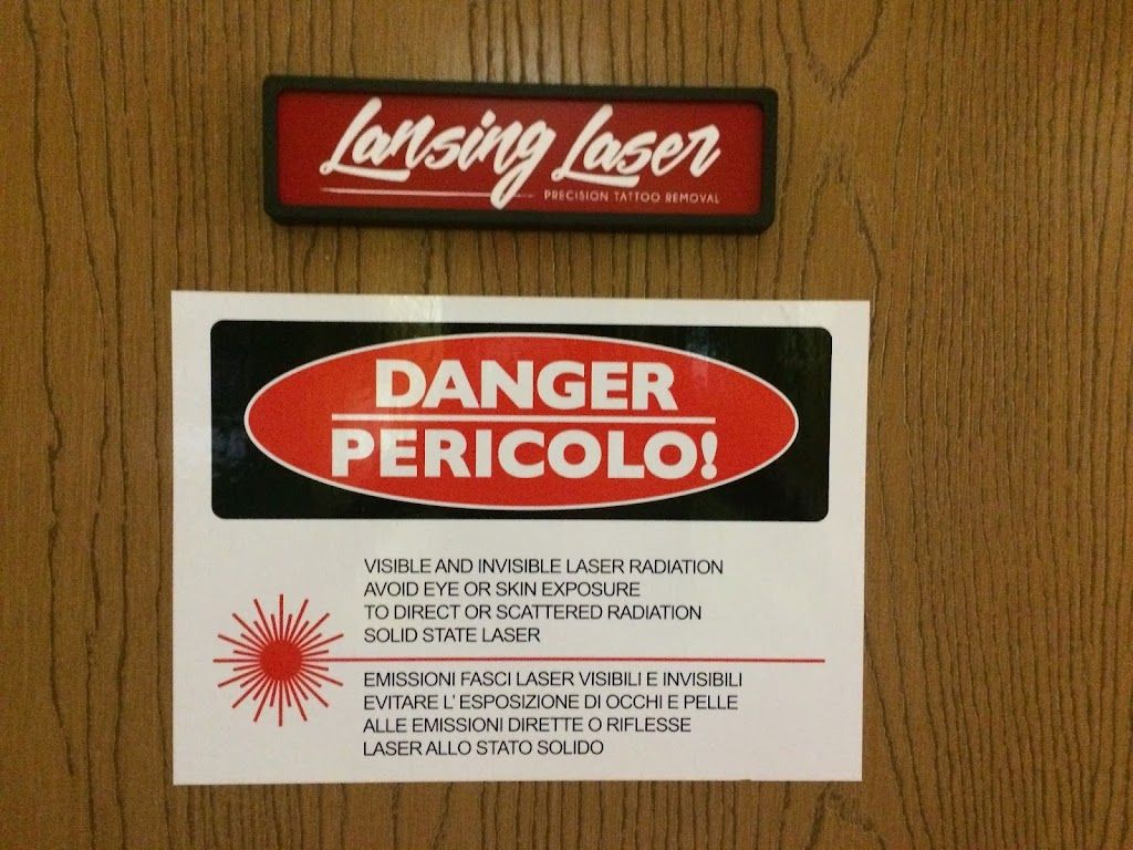 Lansing Laser Tattoo Removal