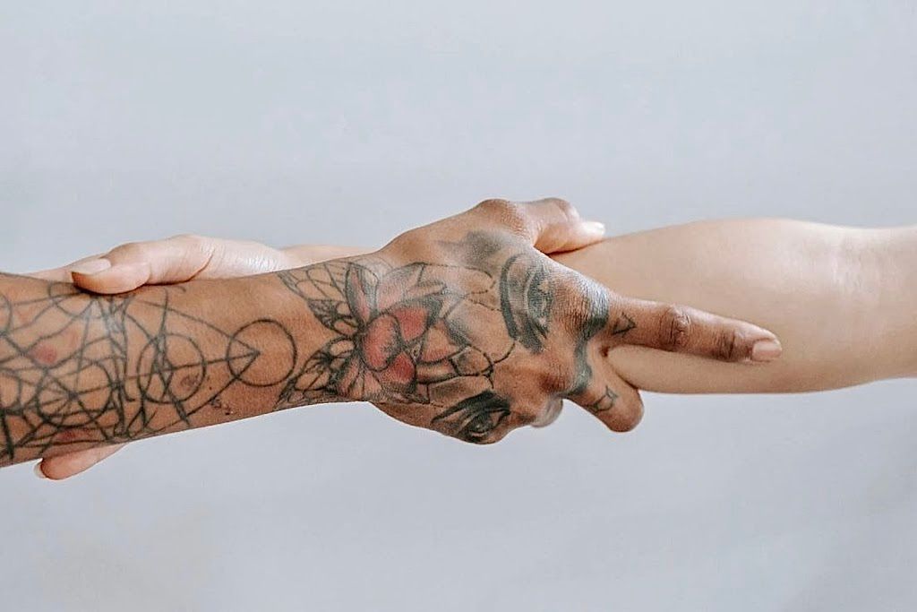 Rapid Tattoo Removal
