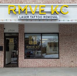 RMVE KC Laser Tattoo Removal