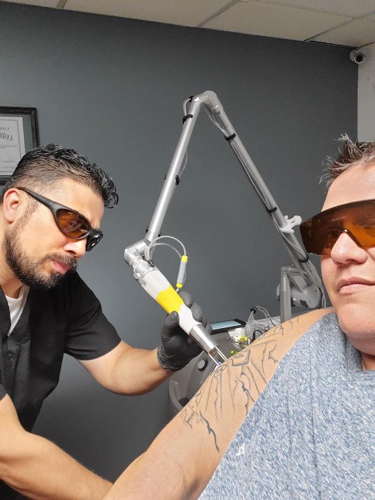 Laserfied Tattoo Removal Milwaukee, WI