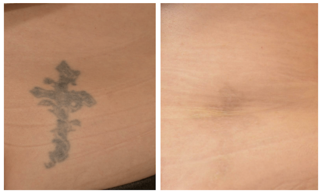 AgeLess Medical Aesthetics and Lasers