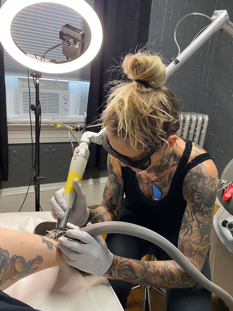 Ink Busters Tattoo Removal and Fading