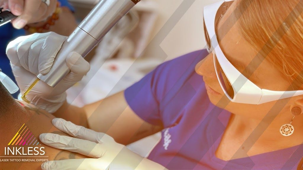 Inkless Tattoo Removal - Main Image