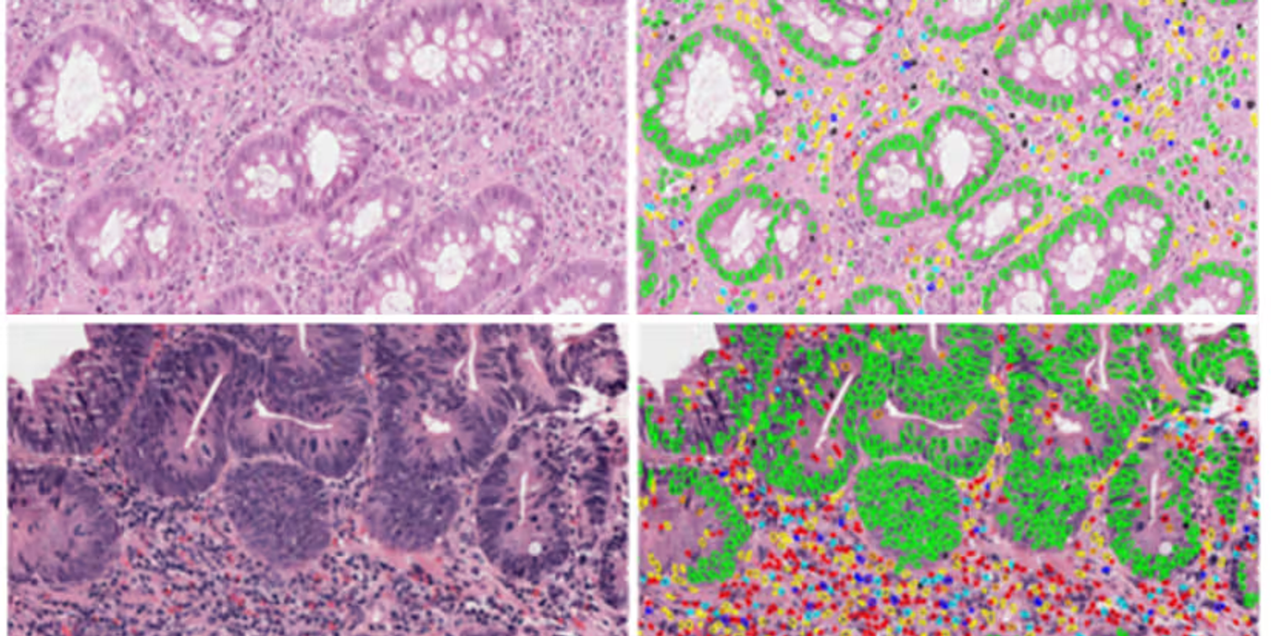 ImmunoProfile