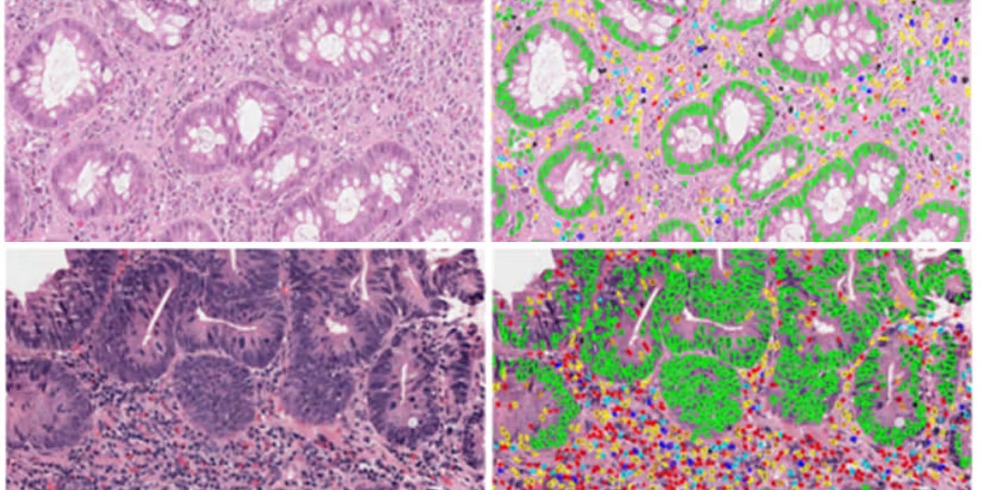 ImmunoProfile