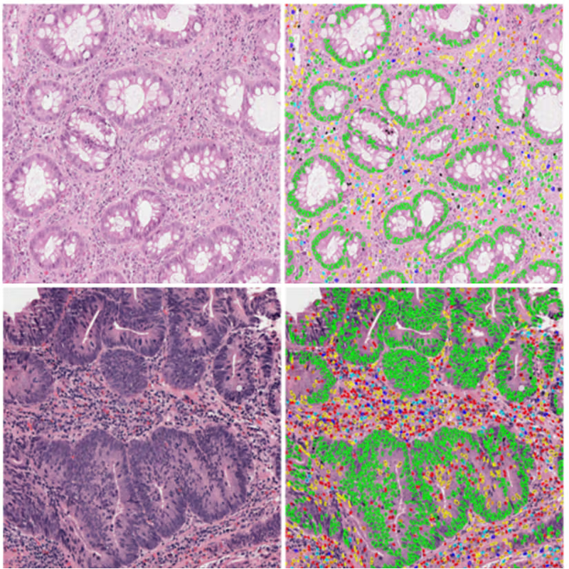 ImmunoProfile