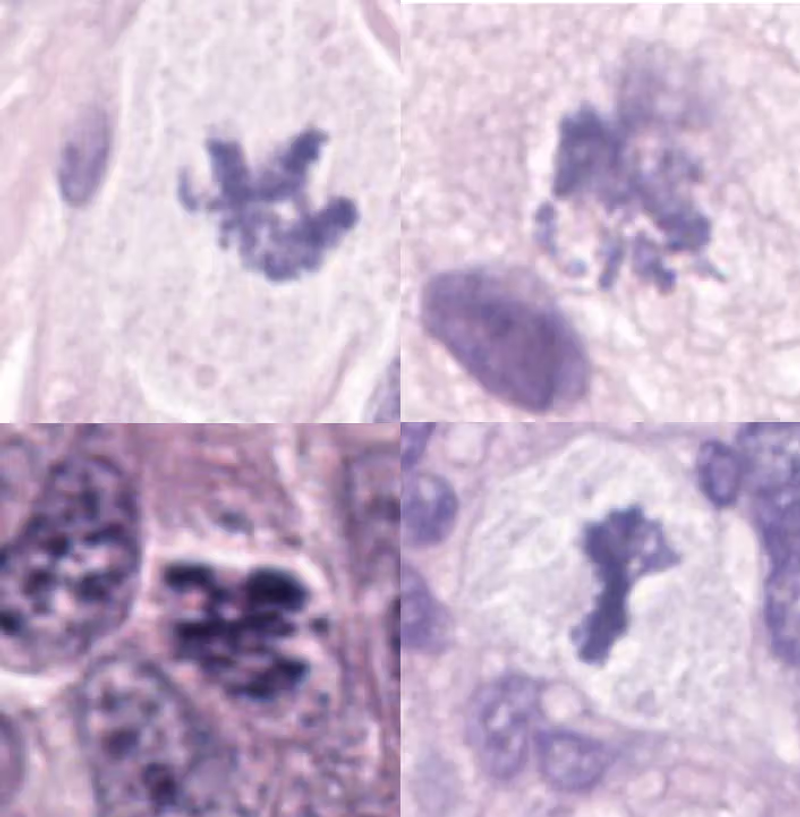 Atypical Mitoses