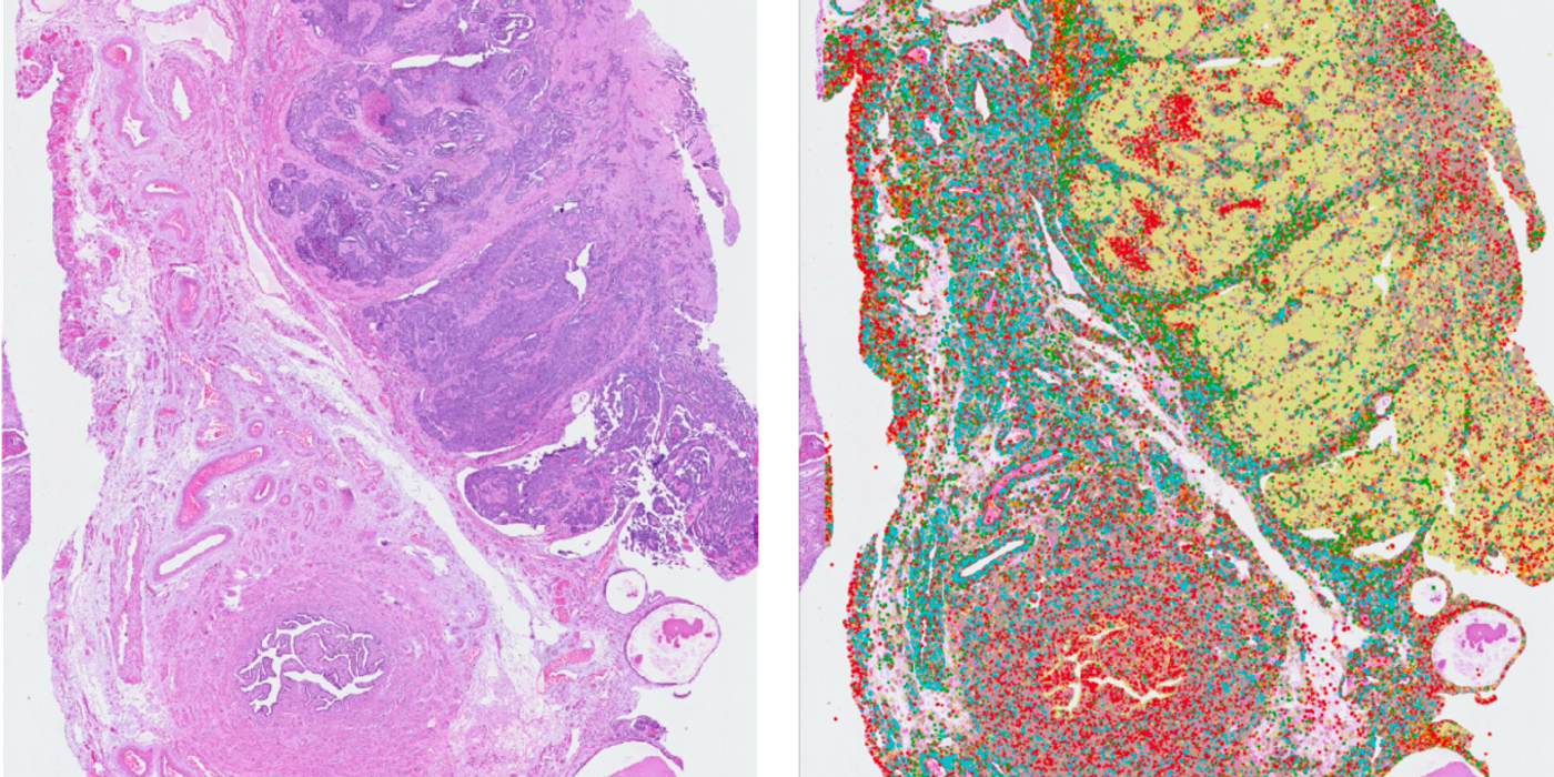 About Ground Truth in AI Single-Cell Detection