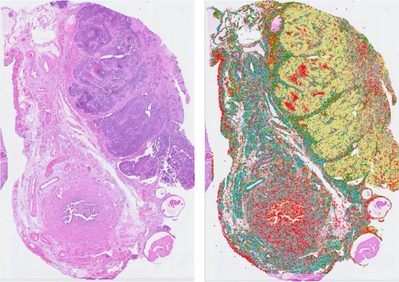 About Ground Truth in AI Single-Cell Detection