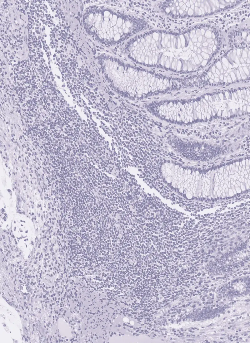 Original pathology slide section