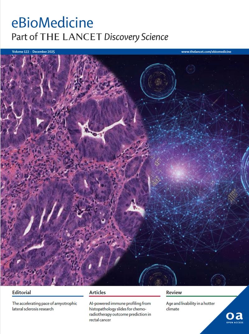 AI tool helps predict treatment success in rectal cancer patients