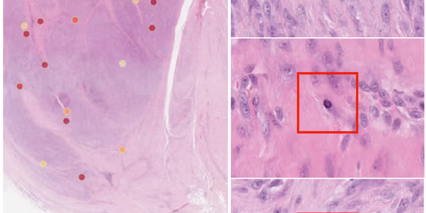 Mitotic Detection