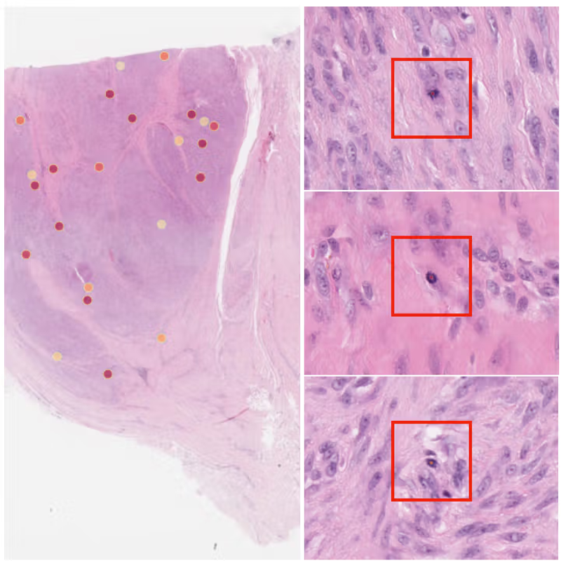 Mitotic Detection