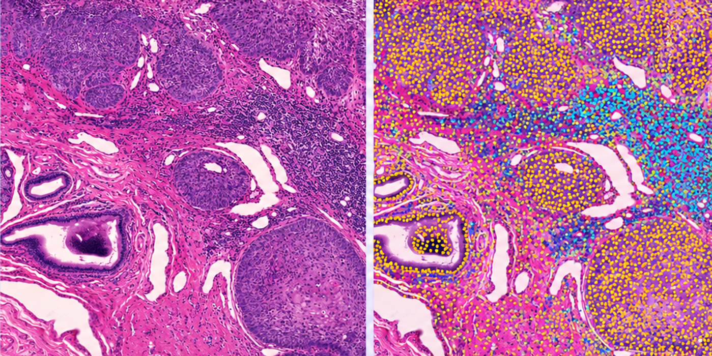 Kraken-1, October 2026: Advancing Cell-Level AI in Computational Pathology