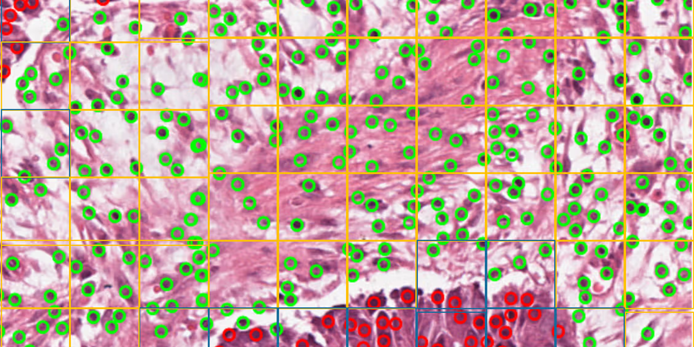 Tumour Cell Density