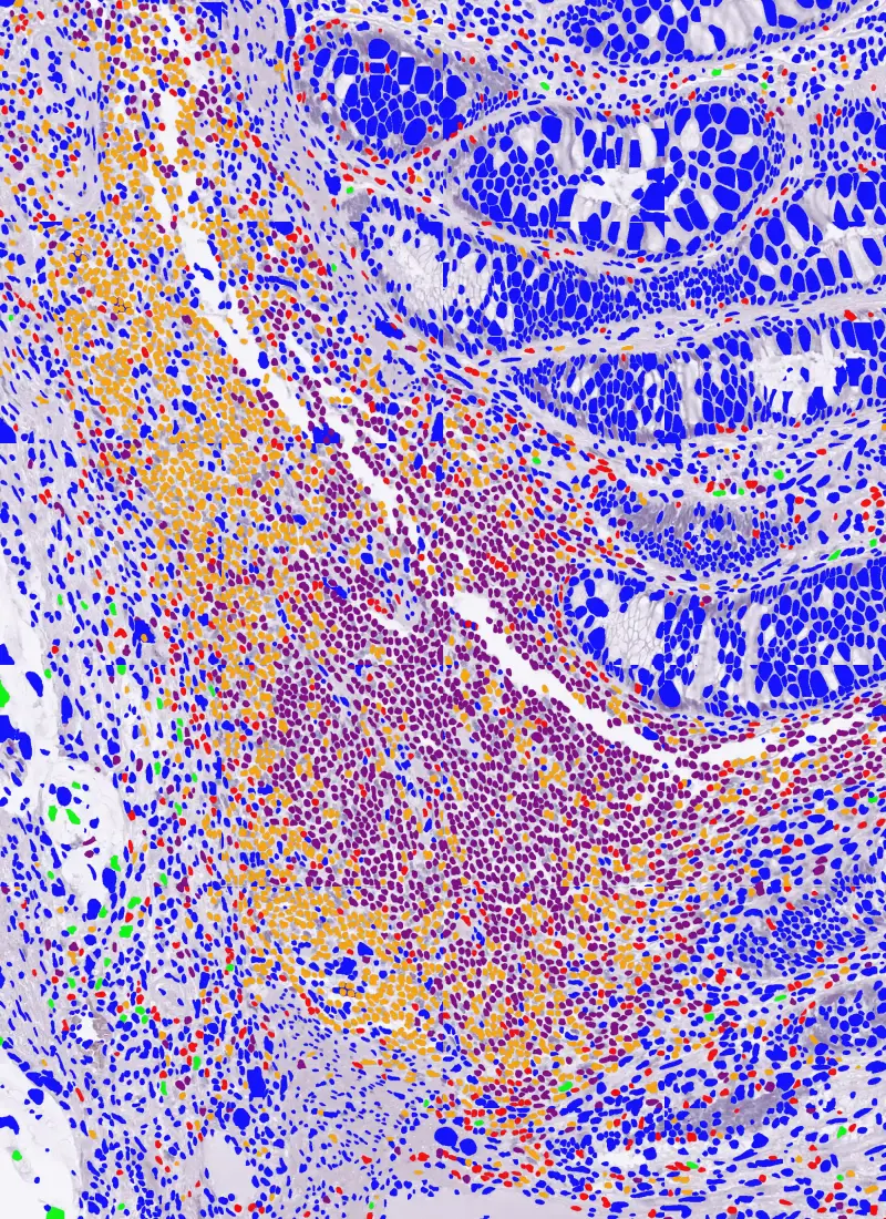 Pathology slide section with AI cell detection overlay