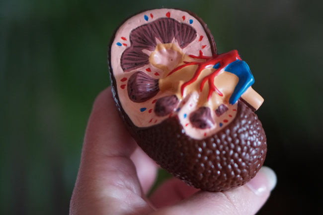 A person holding a model of a human kidney | IDID Nephrology