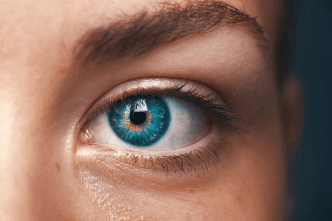 A photo of a person's eye | IDID Ophthalmology