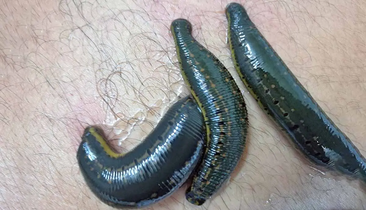 three leeches on someone_s skin