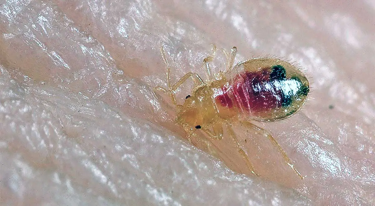 bed bug on a person_s skin