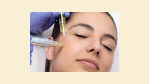 Exosome Treatment 