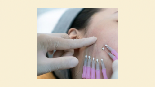 Facial Contouring