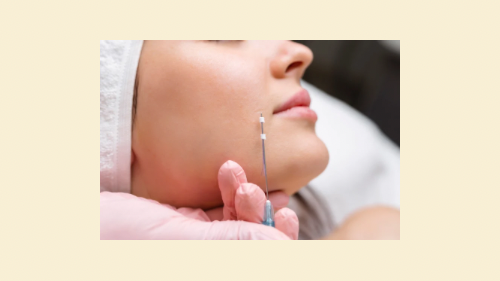 PDO Thread Face Lift 