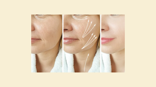 Lower Face Filler 