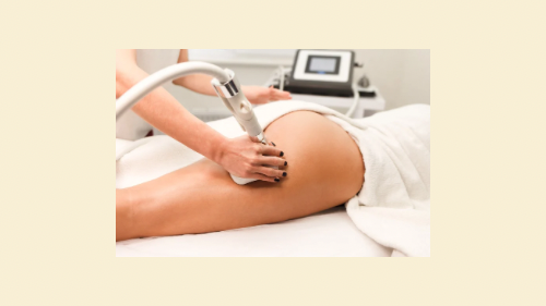 Fat/Cellulite Improvement