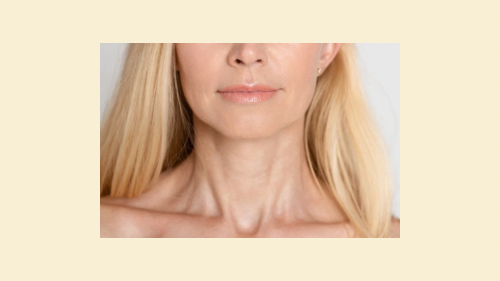 Platysma Bands