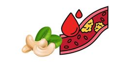 Do Cashews Contain Cholesterol? How Much Cholesterol Is In Cashews?