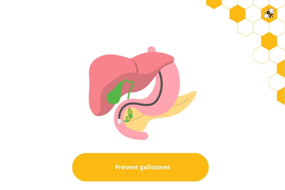 Prevent gallstones