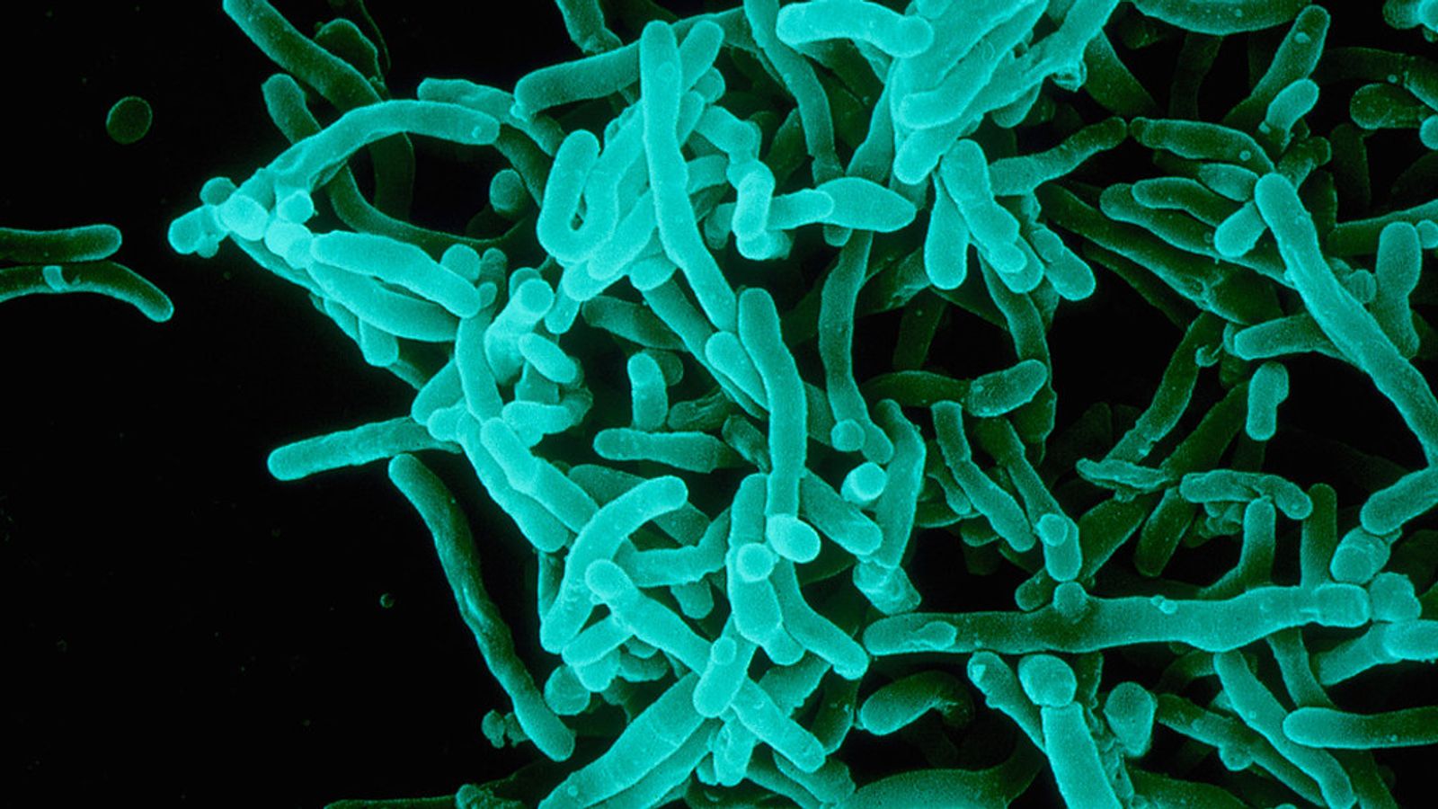 Microbiota, probióticos y prebióticos