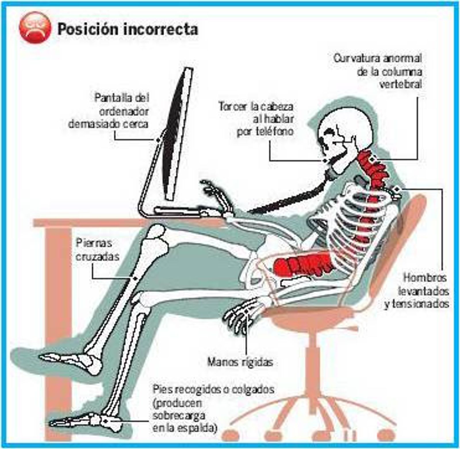 postura-mala