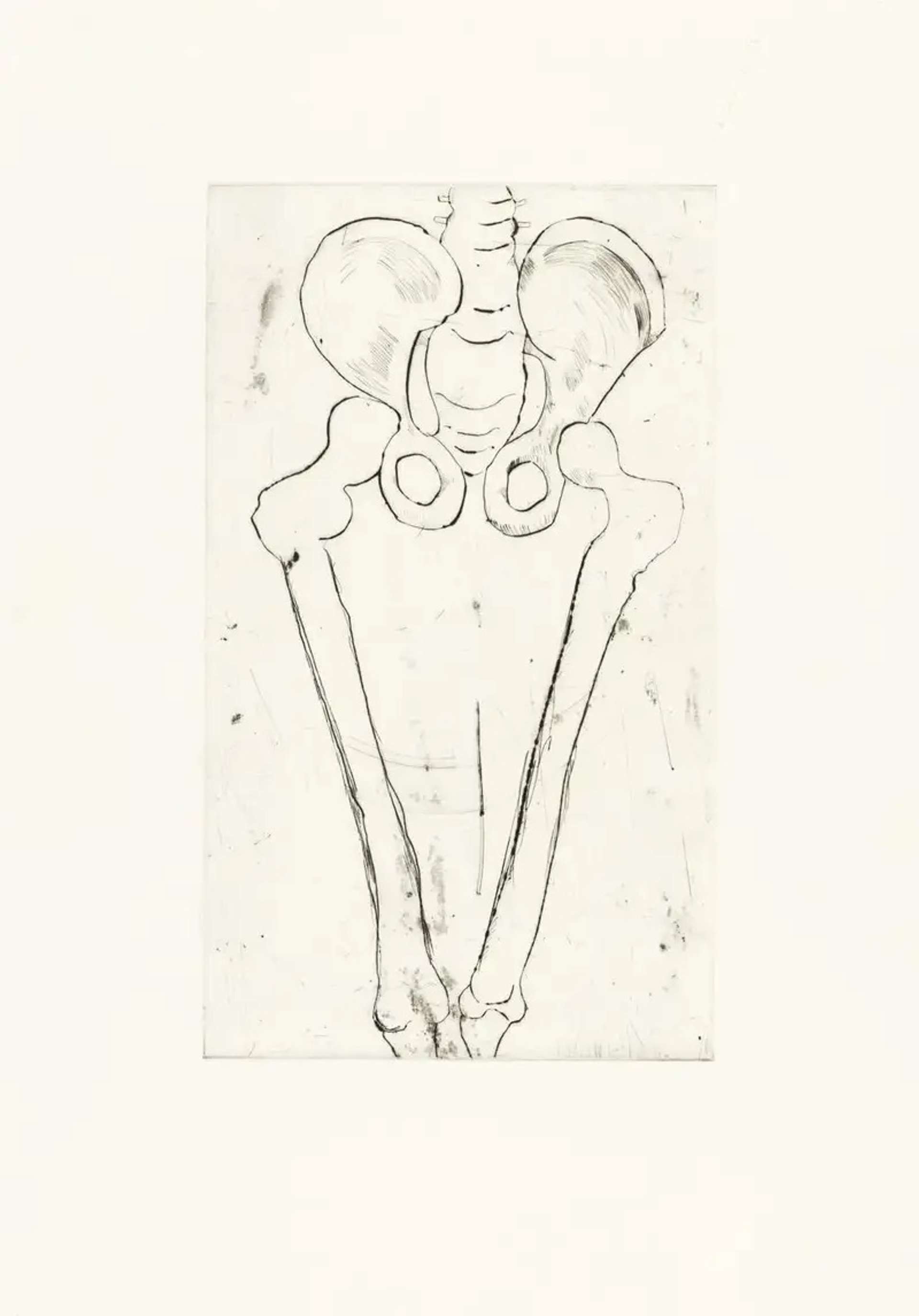 Louise Bourgeois Untitled No. 8. A monochromatic etching of an anatomical depiction of a pelvis and leg bones.