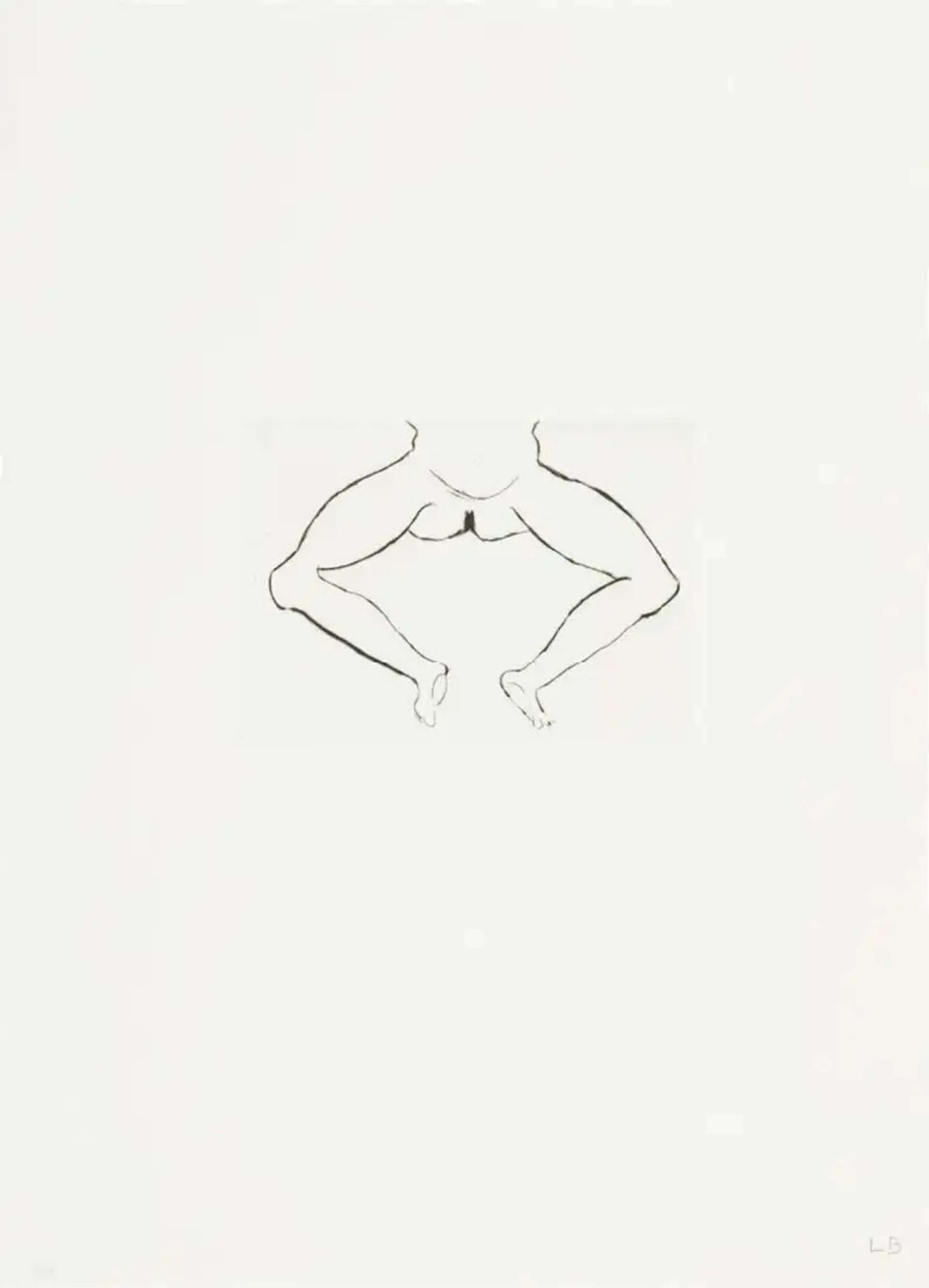 Louise Bourgeois Untitled No. 7. A monochromatic etching of a depiction of the nude lower half of a woman’s body.
